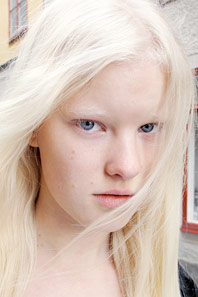 Linn Arvidsson