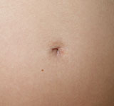 Abortion