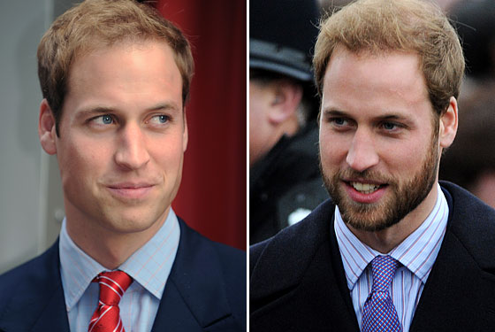 prince williams hair transplant. Prince William - As good as