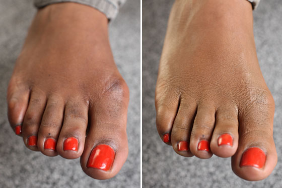Ugly Feet? Try Concealer. 5/8/09 at 12:35 PM; Comment. Before and after.