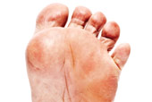 Pedicures