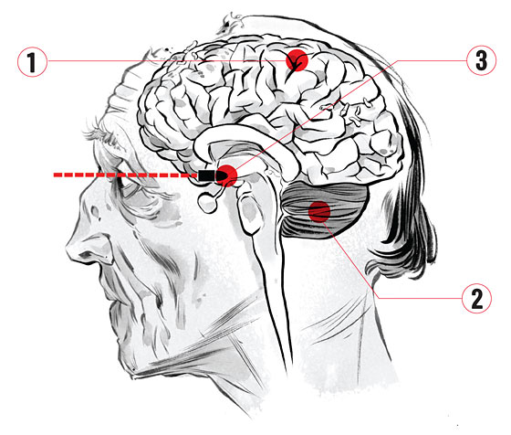 Inside zombie brains: Sci-fi teaches science 